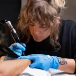 Chicago tattoo removal